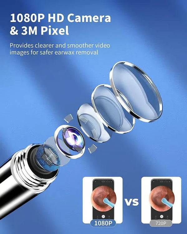 Smart Visual Otoscope Ear Wax Removal Tool, Ear Wax Removal Tool, Mini Camera for Ear Health Care